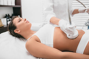 Woman receiving T-shock Cryo Body Sculpting Treatment