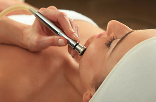 Woman receiving Microderm Treatment