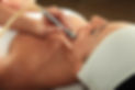 Microderm Treatment.jpg