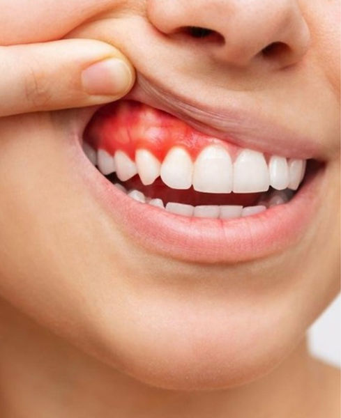 periodontia.jpg