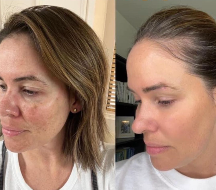 How The Cure X Soap Changed My Life (And My Skin!)