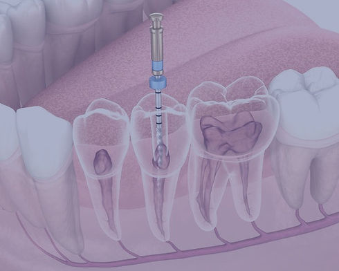 ENDODONZIA_edited.jpg