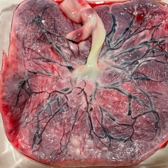 Beautiful cleaned placenta about to be steamed and dehydrated!