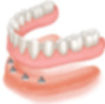 dentures