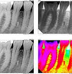digital x-rays all 4 contrasts.jpg