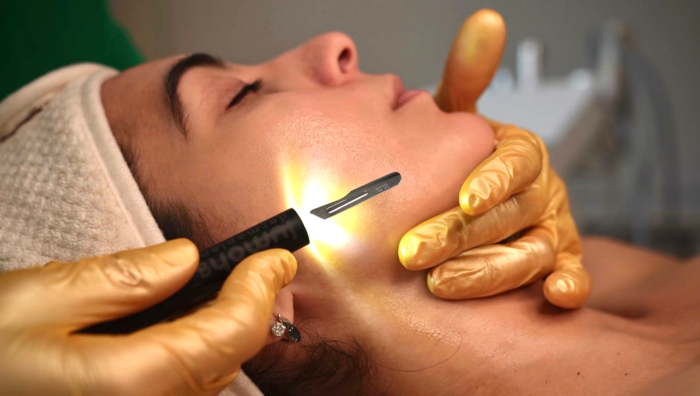 dermaplaning facial boca raton