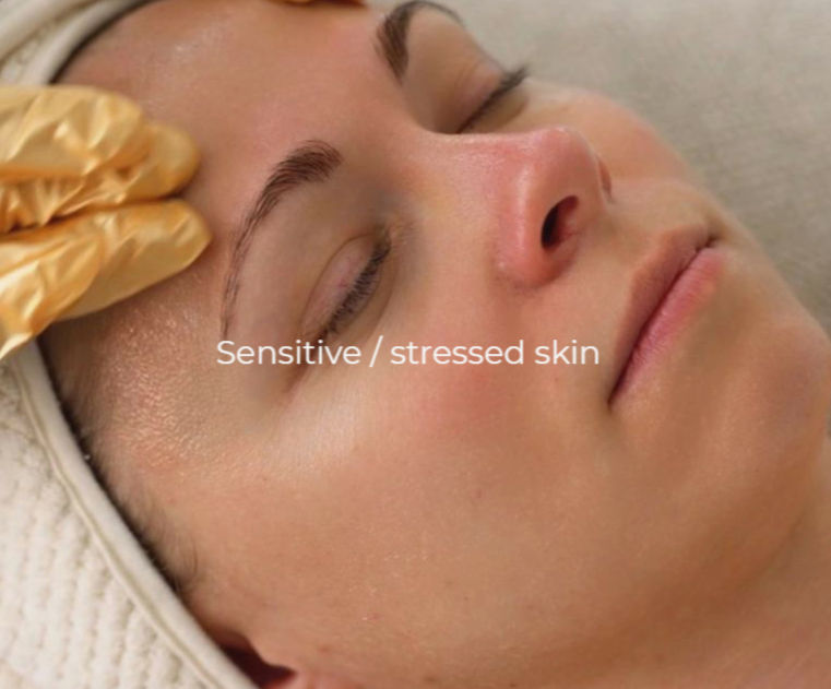 Facial Boca Raton