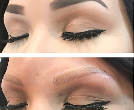 Microblding Eyebrows for Alopecia Patient