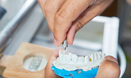 fixer-implants-dentaires-ceramique.jpg