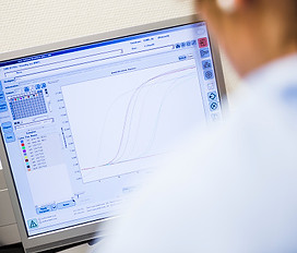Gráfico en el equipo