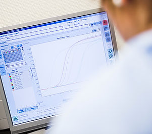 Graph on Computer