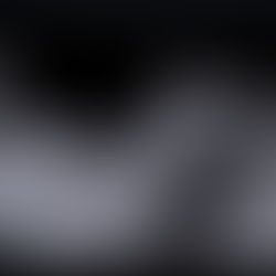 Ecografía morfológica: qué es, cuándo se realiza y qué detecta