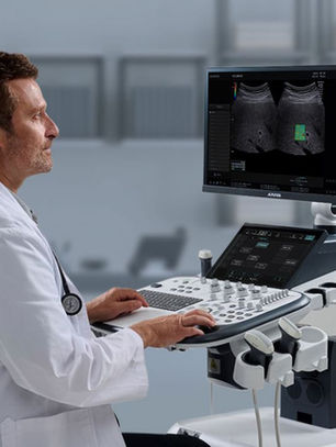 Ecografo con elastografia hepatica