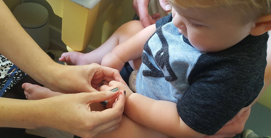 baby acupuncture ralph.JPG