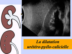 Savoir_diagnostiquer_une_dilatation_