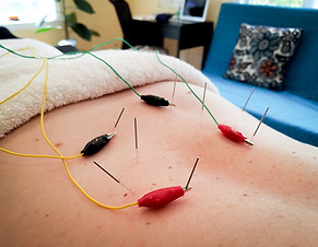 Electrical Stimulation