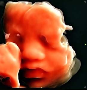 3D Baby Face