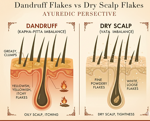 Ayurvedic comparison of dandruff vs dry scalp with scalp conditions and flake types