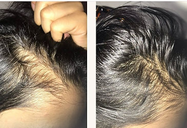 Before and After using melina hair oil