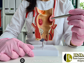 Understanding and Managing Piles: Insights from Jindal Endo-Laparoscopy Hospital