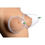 Thumbnail: Breast Cupping System