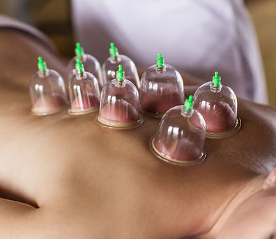 cupping.jpg