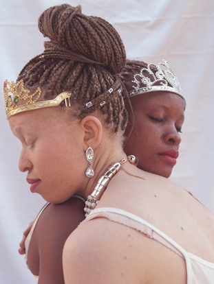 Two crowned queens, eyes closed, holding each other in quiet strength—softness as power, sisterhood as sanctuary.