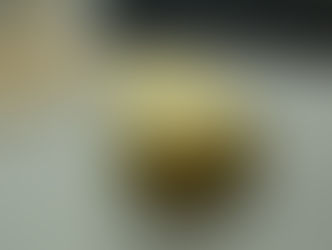 吃到綠薯條會怎樣 毒性症狀一次搞懂