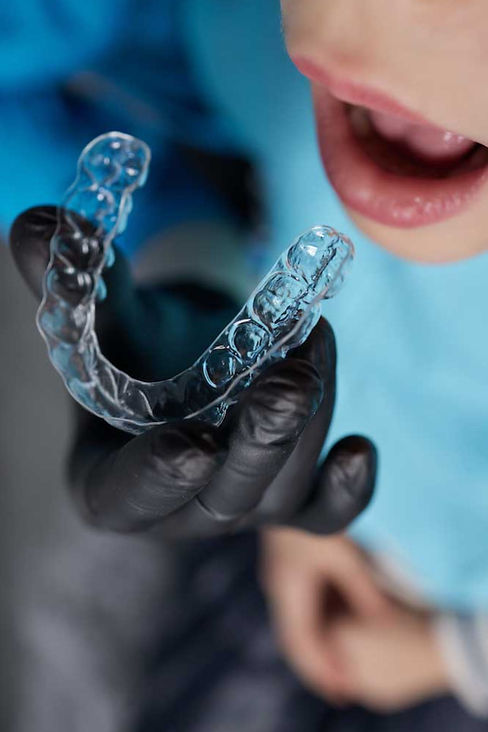 allineatori-dentali-trasparenti_edited.jpg