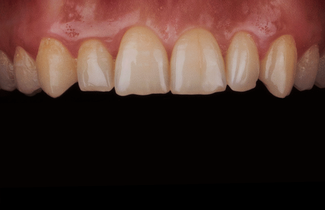 Brisbane Dental Dental Clinic 420 Street, Brisbane City QLD