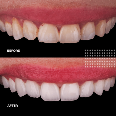 teeth