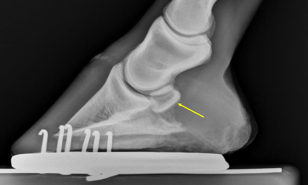 Severe Navicular Disease in a Horse