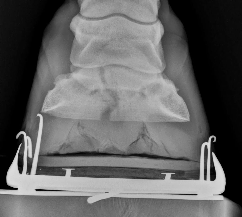 Coffin bone fracture in a horse.