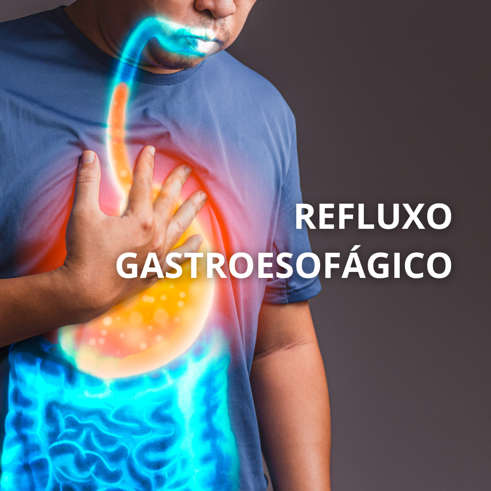Ilustração do refluxo gastroesofágico