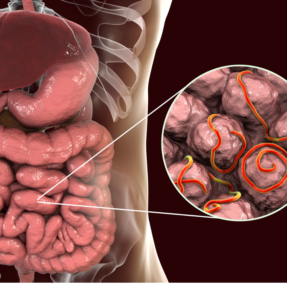 Ilustração da microbiota intestinal em desequilíbrio