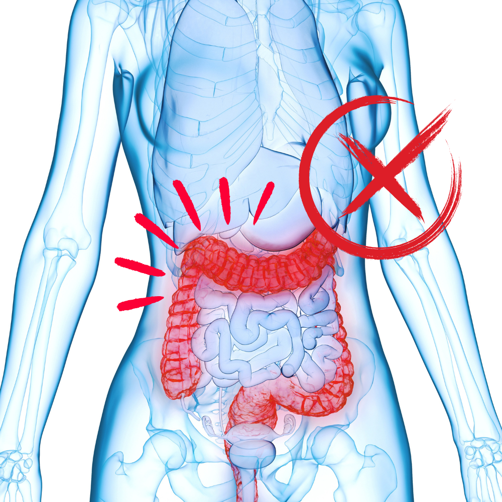 Inflamação intestinal