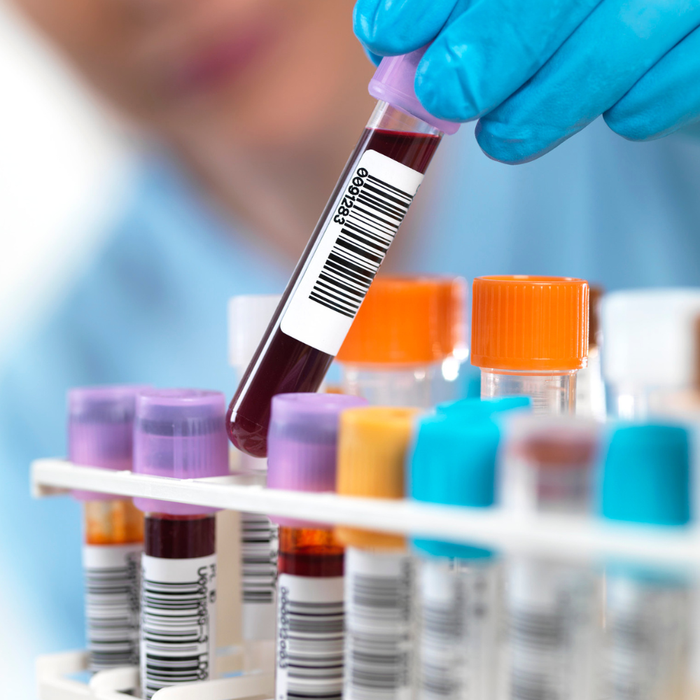 Exames laboratoriais para análise da microbiota