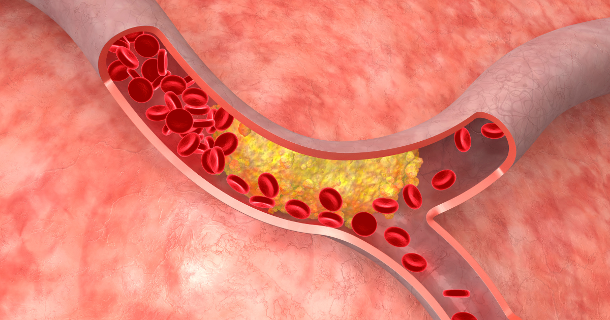 Efeito do EPA sobre inflamação vascular