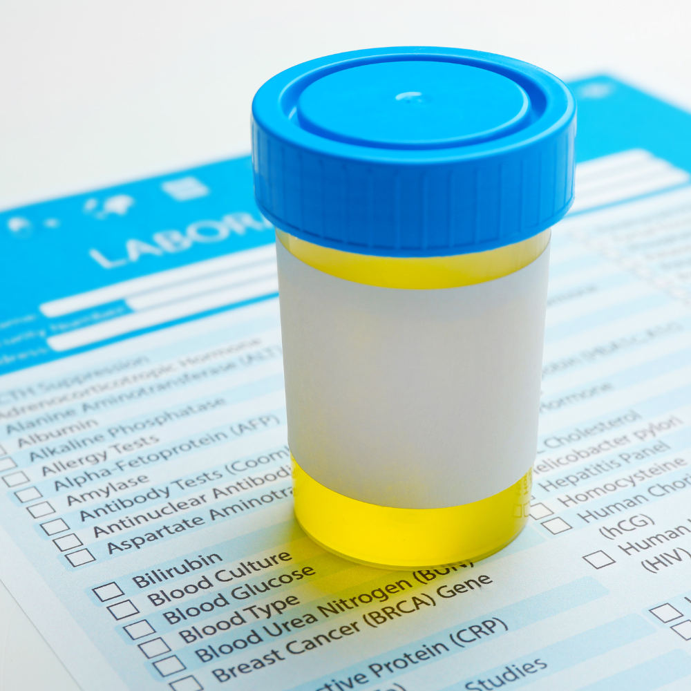 Amostras para metabolômica