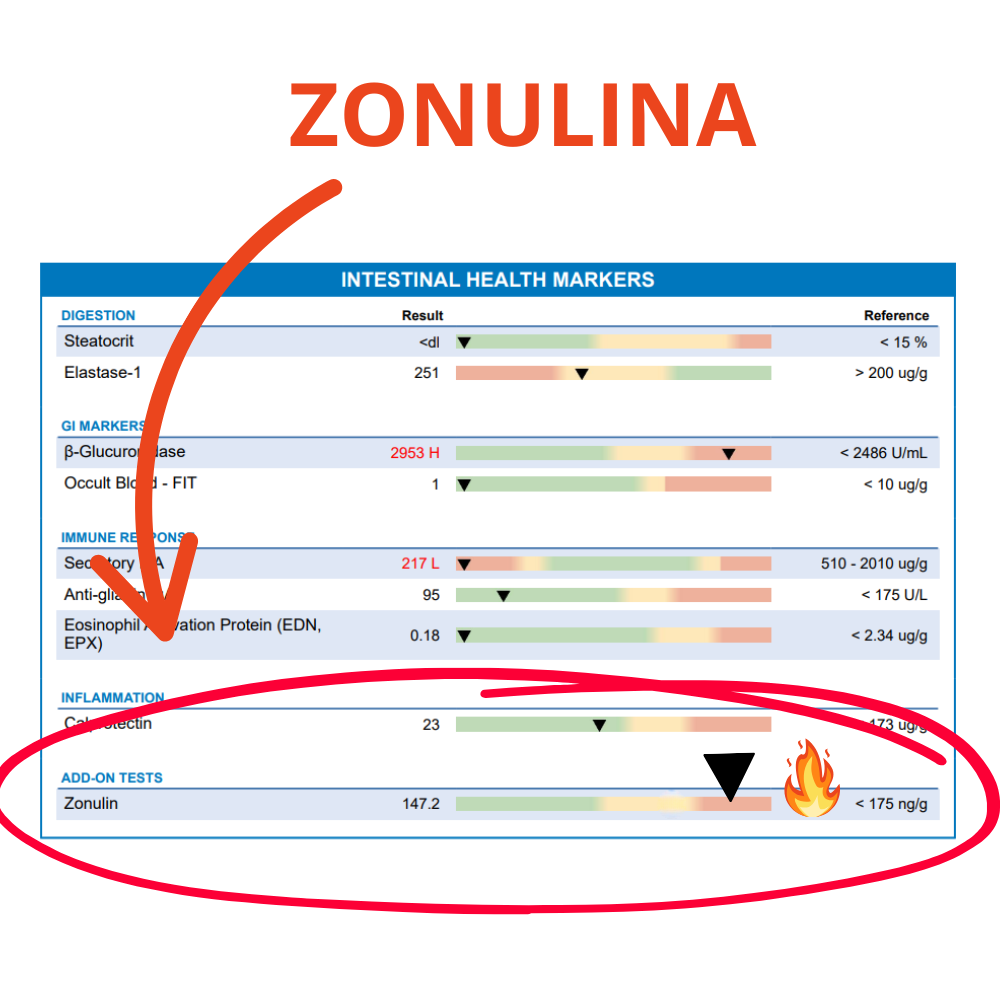 Exame laboratorial de zonulina