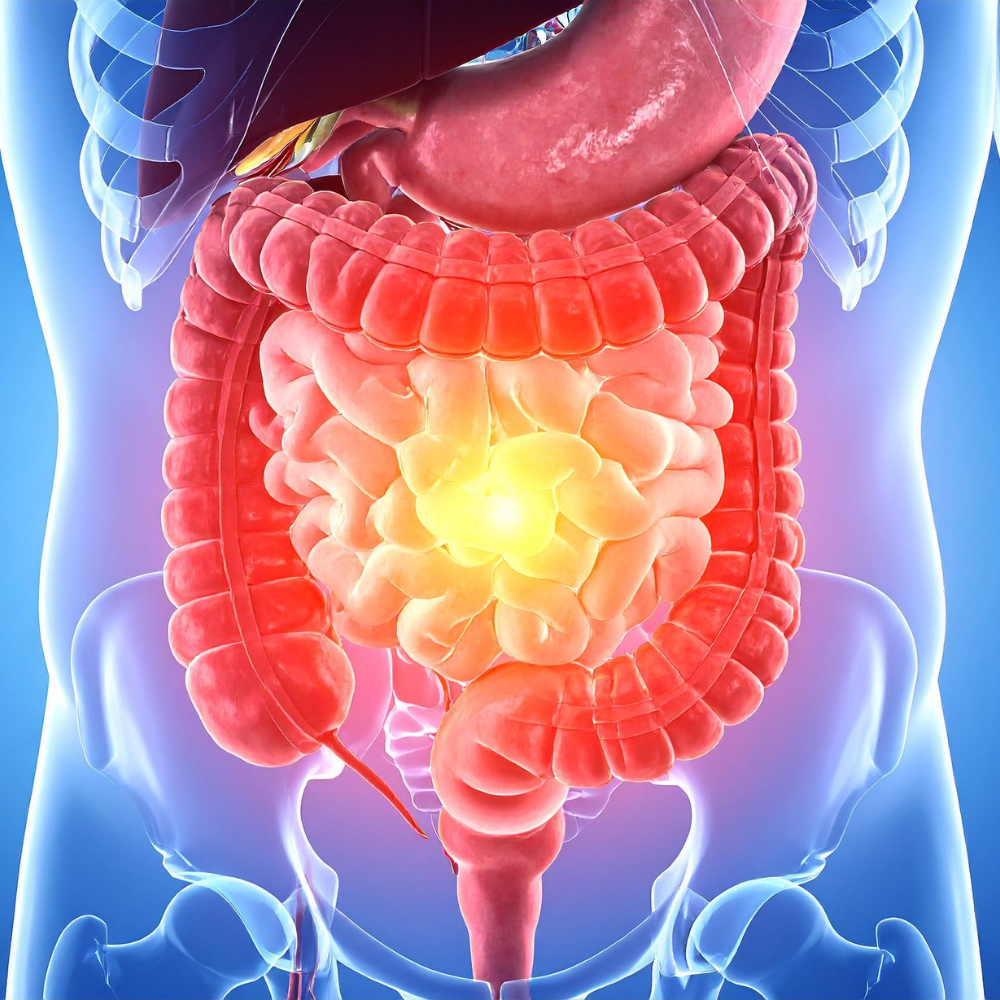 Ilustração do sistema gastrointestinal com acúmulo de gases