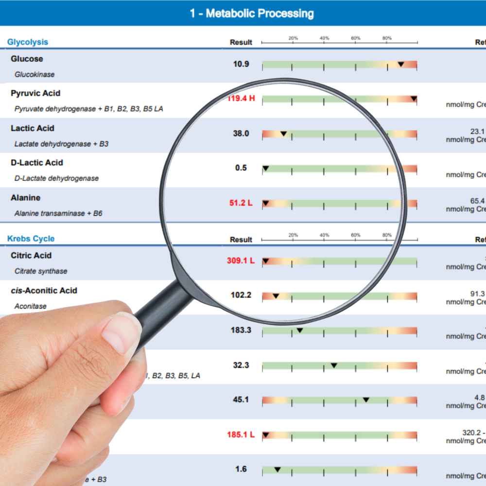 Exame de metabolômica mostrando perfis metabólicos