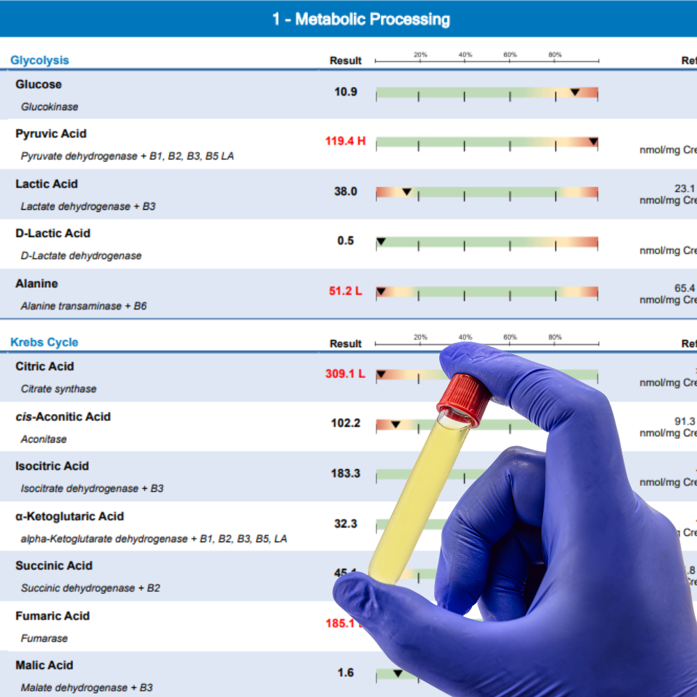 Relatório de exame de metabolômica