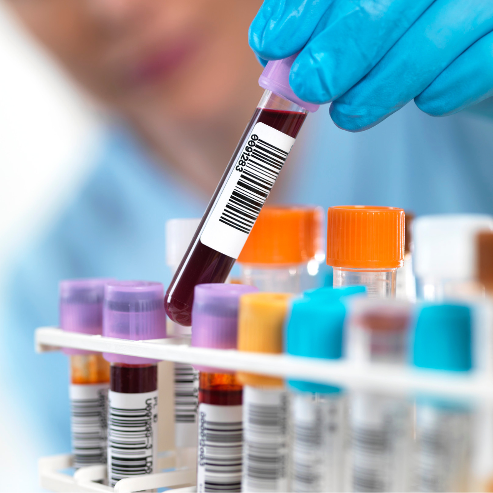 Exame de metabolômica para análise de vias antioxidantes