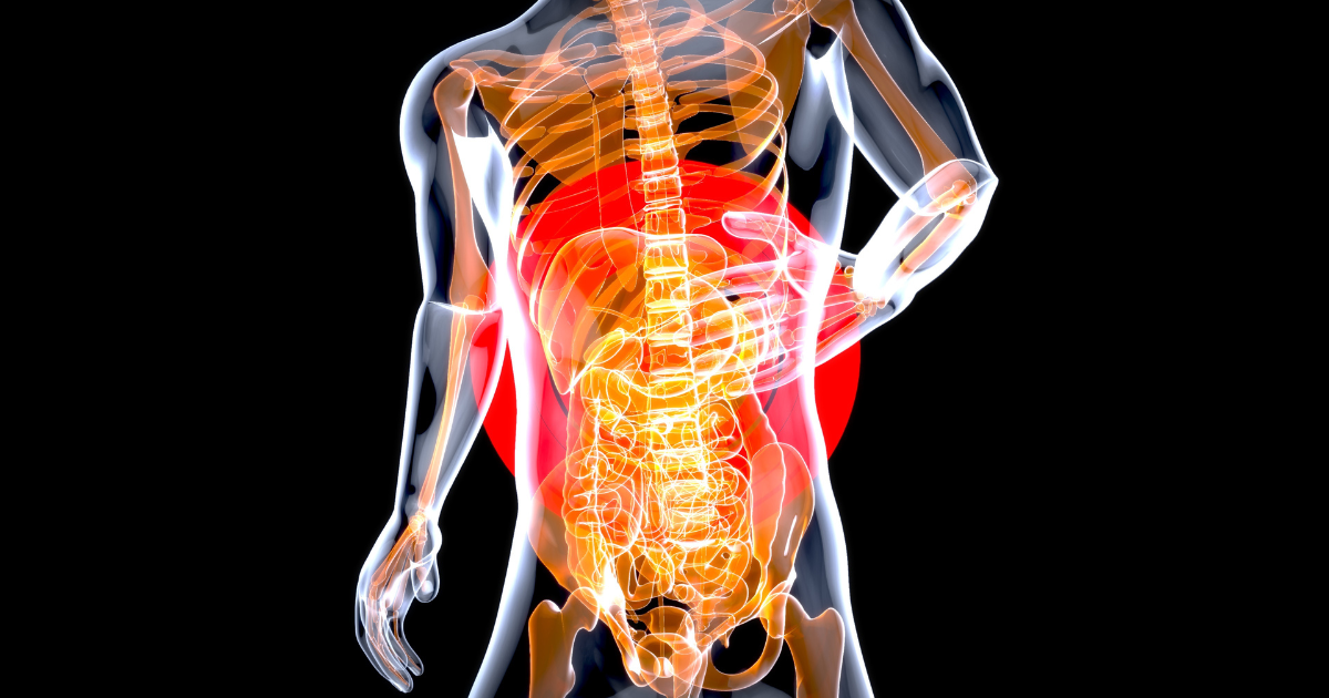 regiões do abdômen associadas à cólica abdominal