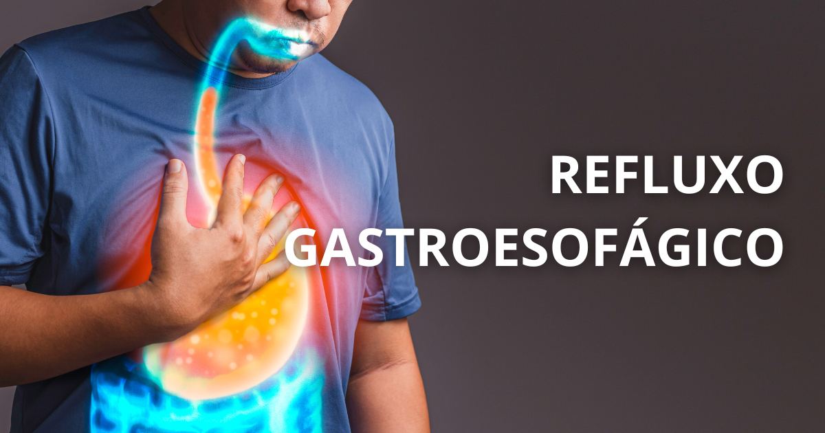 Ilustração do refluxo gastroesofágico