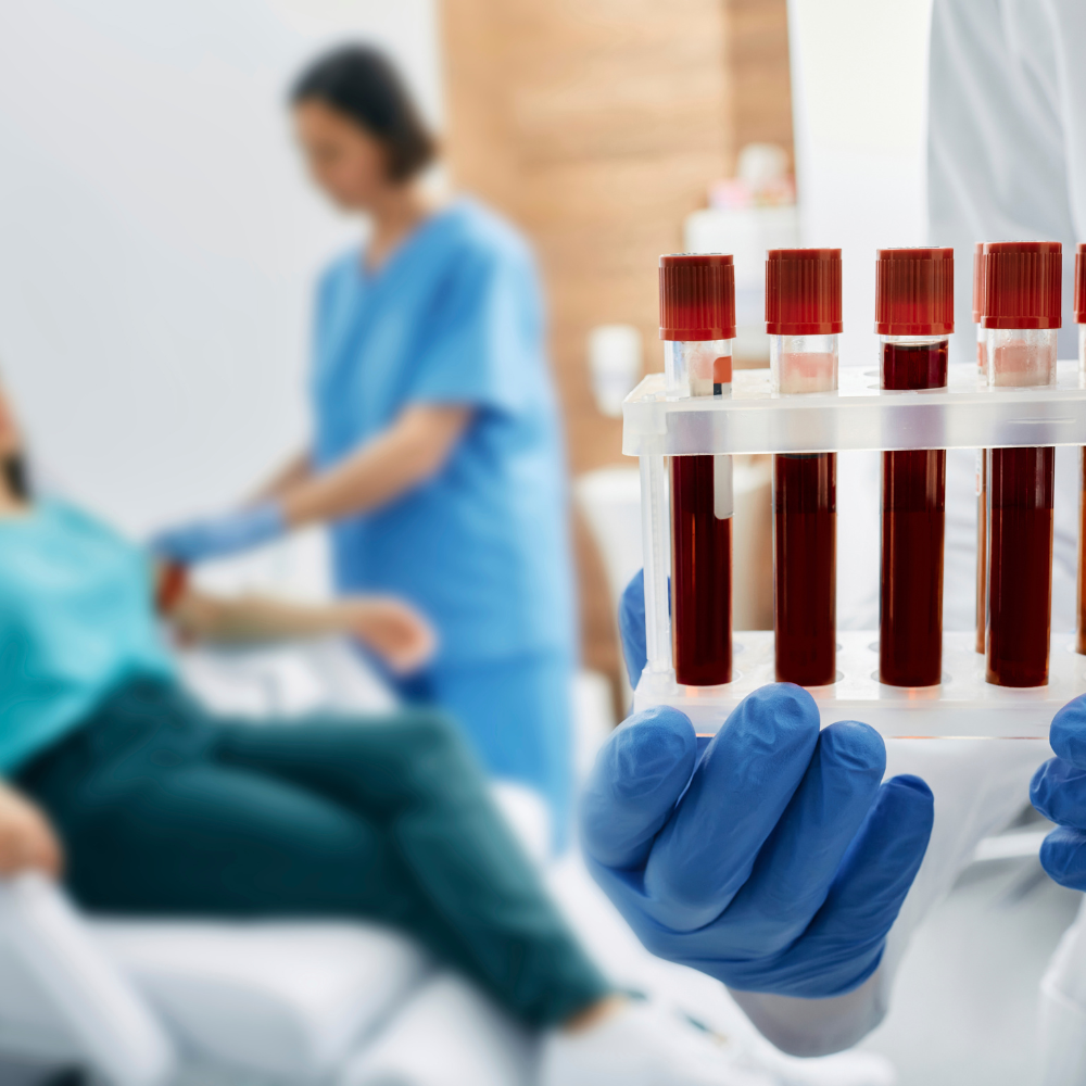 Exame de vitamina B12 em acompanhamento clínico