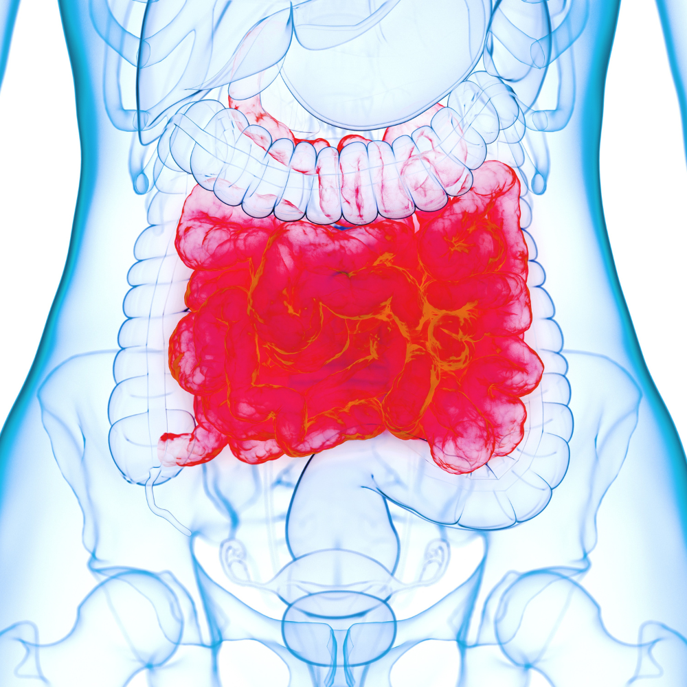 Ilustração do intestino inflamado