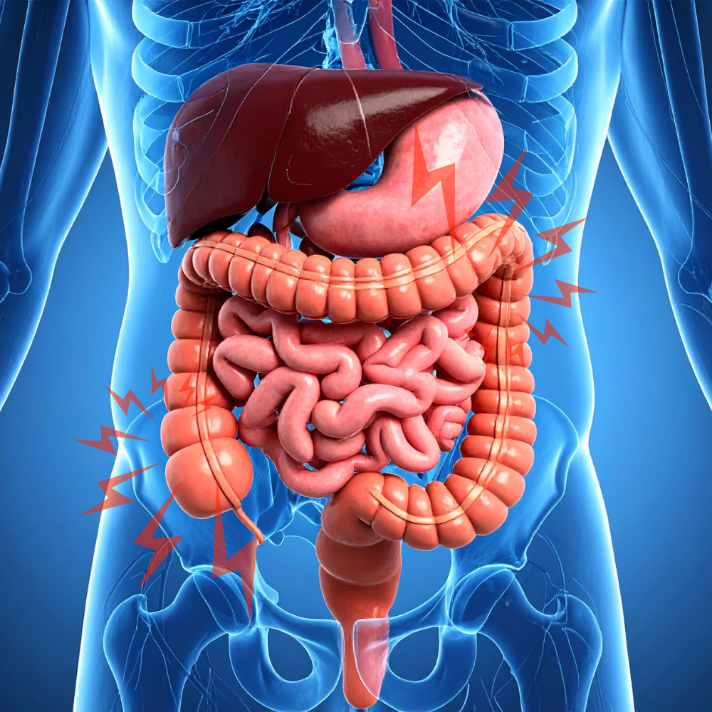 Intestino humano com dor abdominal