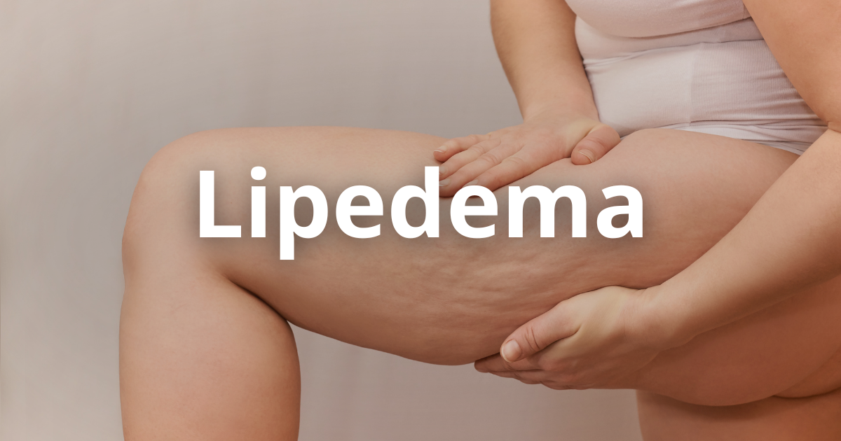 Representação do lipedema no corpo